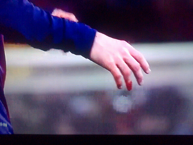 图片:梅西的手指流血了.[vi