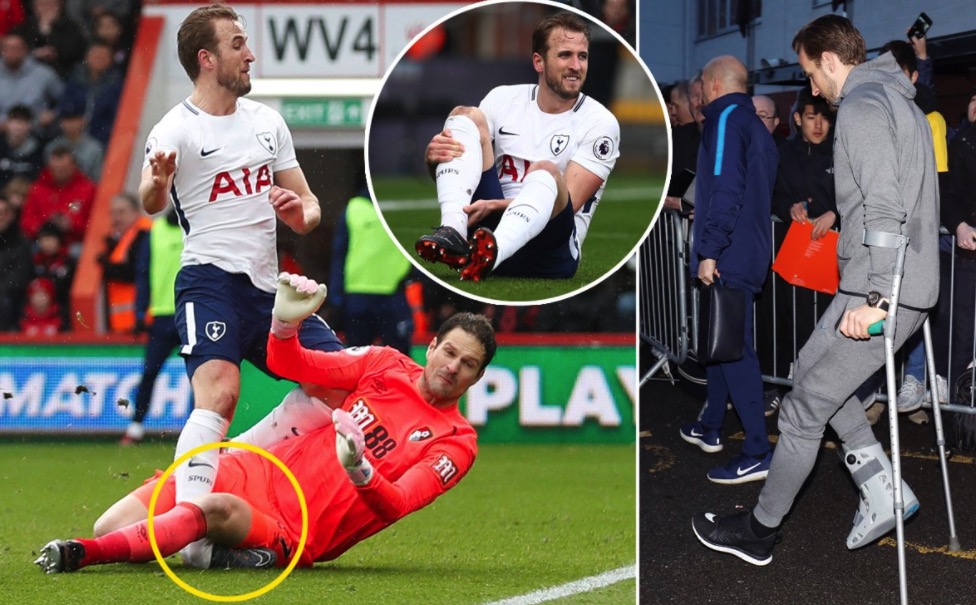 凯恩拄拐离场，波切蒂诺：明天过后才能确定他的伤情