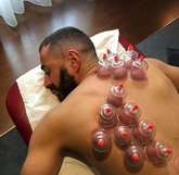 怕是拔上瘾了！本泽马再次晒出自己拔气罐的照片